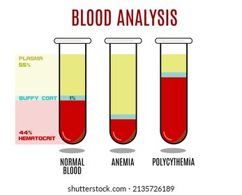 Blood Analysis Infografics. Plasma And Hematocrit, Buffy Coat. Deviation Of Blood - Anemia And Polycythemia