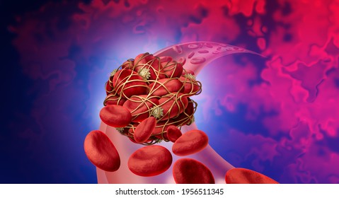 Blood clot health risk or thrombosis medical illustration concept as human blood cells clumped together with sticky platelets and fibrin as a blockage in an artery or vein as a 3D render.
