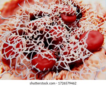 Blood Clot (thrombus). Erythrocytes (red Blood Cells) Are Trapped Within A Fibrin Mesh. 3d Rendering
