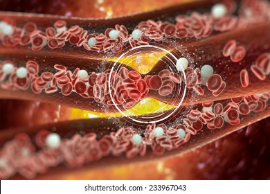 Blood Clot, Vein, Artery, Tunnel, Red Blood Cells, Internal Body, Blood Cell, Heart