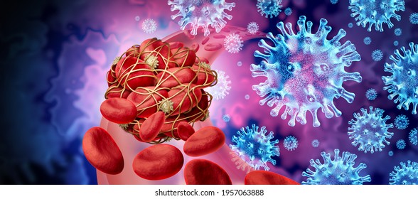 Blood Clots And Virus Infection And Coronavirus Or Influenza As Cells Clumped Together With Sticky Platelets And Fibrin As A Blockage Risk Of Clotting And Clot Concept With As A 3D Render.