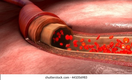 Blood Flow In Vessels 3d Illustration