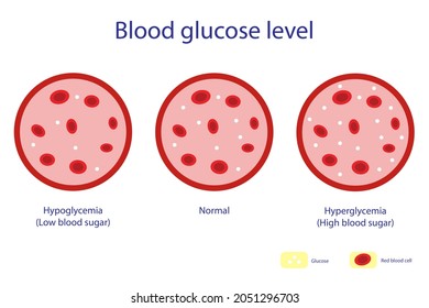Blood glucose level comprising low, normal and high in blood vessel on white background.