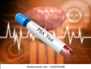 Blood sample in laboratory test tube for PSA examination for detection of prostate disorders and diseases. 3D rendering
