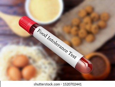 Blood Sample In Test Tube For Food Intolerance Test In Laboratory. 3D Rendering