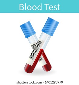 Blood Test Medical Illustration Two Tubes Stock Illustration 1401298979 ...