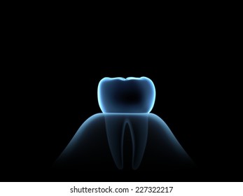 Blue X-ray Molar.