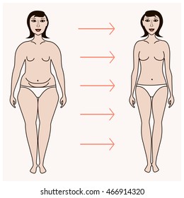 Body Woman Correction Cellulite Fat Plastic Surgery Infographics For Posters Brochures Breast Body Woman Correction Cellulite Fat Plastic Surgery Infographics For Posters Brochures Breast