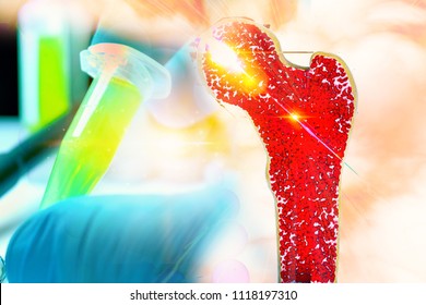 Bone Research Concept Bone Cancer And Stem Cells Treatment Osteoporosis Bone Marrow Bone Problems Diseases 3D Rendering