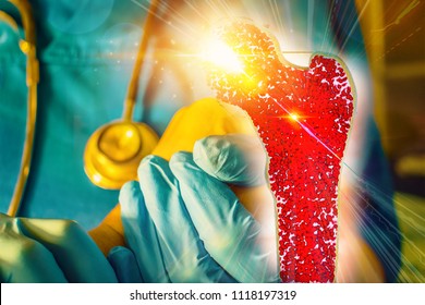 Bone Research Concept Bone Cancer And Stem Cells Treatment Osteoporosis Bone Marrow Bone Problems Diseases 3D Rendering