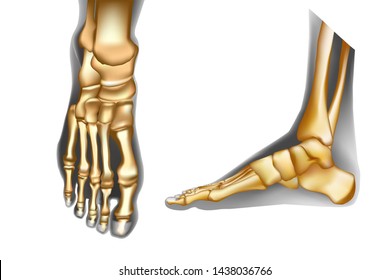 Rheumatoid Artritic Sore Joints Concept Realistic Stock Illustration ...