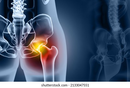 Bones of the pelvis and hip, human anatomy, femur bone joint pain, X ray of the hip joint and femur. 3d illustration