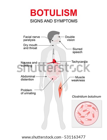 botulism caused toxin bacterium respiratory