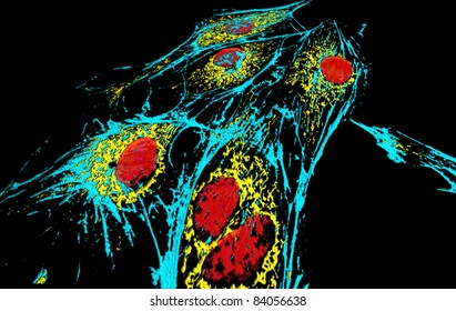 Bovine pulmonary artery epitheliial cells, fluorescent staining and modelling by  surface rendering software. Red - nuclei, blue, microfilaments, yellow - mitochondria.