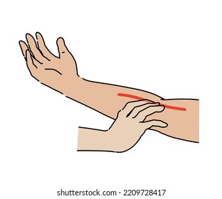 Brachial Artery Tactile
(Medical Related Illustration Material)