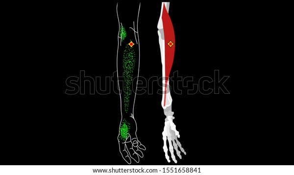 Brachioradialis Muscle Pain Trigger Points Hand Stock Illustration ...