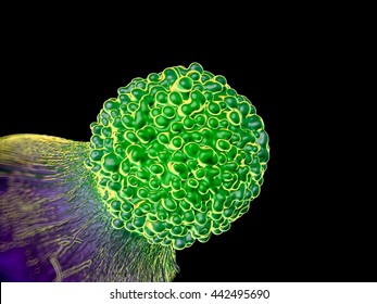 Brain Cancer Cell - 3d Rendering