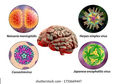 Brain infections, microorganisms that cause encephalitis and meningitis