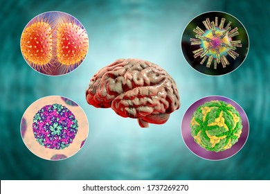 Brain infections, microorganisms that cause encephalitis and meningitis