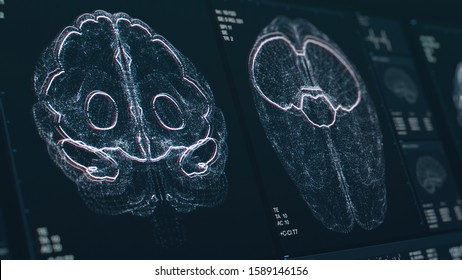 Brain Scan Screen 3D Illustration. Device Scans And Displays Vital Signs. Neurology Data Visualization. Diagnosis Of Disease. Futuristic MRI Image. High Quality Illustration With Depth Of Field Effect