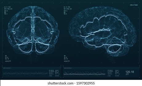 Brain Scan Screen 3D Illustration. Device Scans And Displays Vital Signs. Neurology Data Visualization. Diagnosis Of Disease. Futuristic MRI Image. High Quality Medical Illustration 