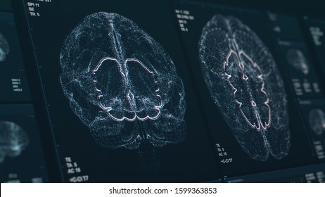 Brain Scan Screen 3D Illustration. Device Scans And Displays Vital Signs. Neurology Data Visualization. Diagnosis Of Disease. Futuristic MRI Image. High Quality Illustration With Depth Of Field Effect