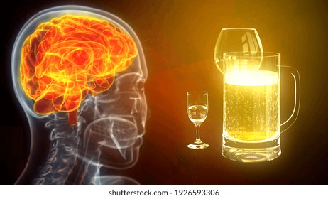 Brain Stricken By Drinks, Cg Medicine 3d Illustration