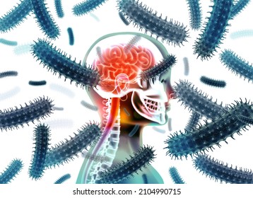 Brain Viral Infection. 3d Illustration