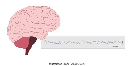 Brain Wave, EEG (Electroencephalography) illustration