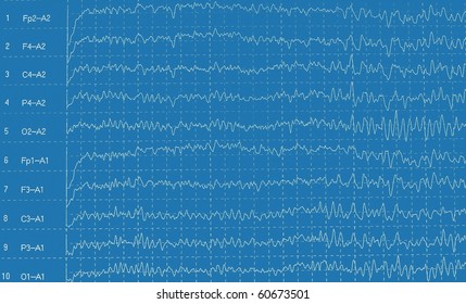 Brain Wave Electroencephalogramme (EEG)