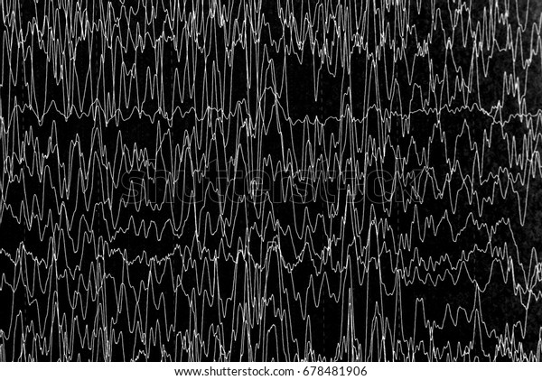 Brain Wave On Eeg Background Electroencephalogram Stock Illustration ...