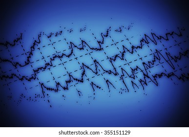 Brain wave on electroencephalogram EEG for epilepsy