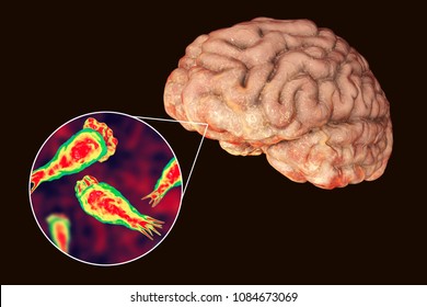 Brain-eating Amoeba Infection, Naegleriasis. Trophozoite Form Of The Parasite Naegleria Fowleri And Brain Encephalitis Caused By Amoeba, 3D Illustration