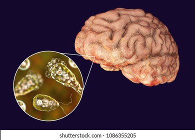 Brain-eating Amoeba Infection, Naegleriasis. Trophozoite Form Of The Parasite Naegleria Fowleri And Brain Encephalitis Caused By Amoeba, 3D Illustration