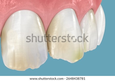 Broken and damaged front teeth. 3D illustration