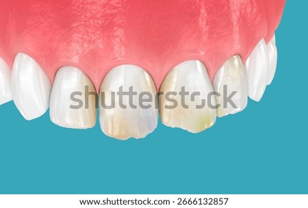 Broken and damaged front teeth. 3D illustration