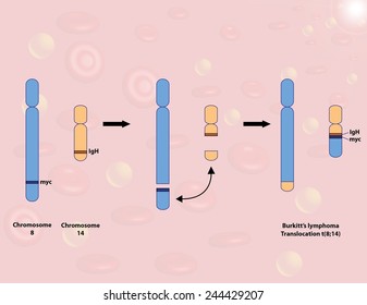 Burkitt's Lymphoma Chromosomal Translocation