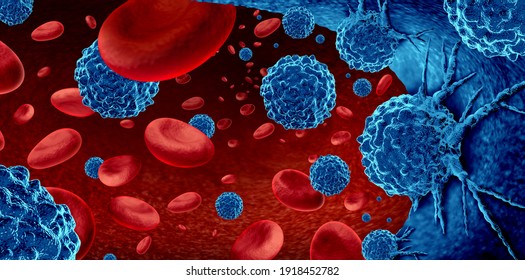 Cancer in the blood outbreak and treatment for malignant cells in a human body caused by carcinogens and genetics and leukemia or lymphoma symbol and medical therapy as a 3D render.
