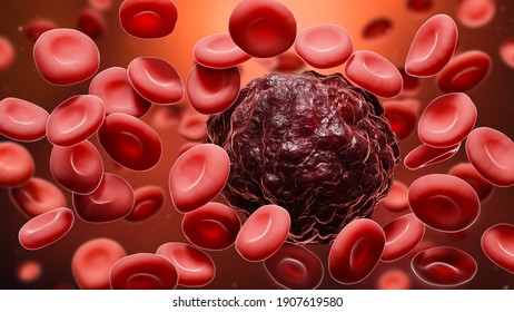 Cancer Cell Amidst Red Blood Cells 3D Rendering Illustration. Oncology, Cancerology, Metastasis, Medicine, Microbiology, Science, Illness, Health Concepts.