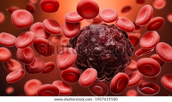 Cancer cell amidst red blood cells 3D\
rendering illustration. Oncology, cancerology, metastasis,\
medicine, microbiology, science, illness, health\
concepts.