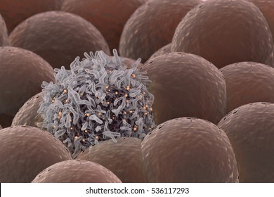 Cancer Cell Among Healthy Cells 