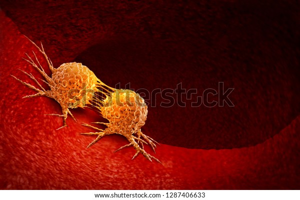 Cancer cell dividing and treatment for\
malignant cancer cells in a human body caused by carcinogens with a\
cancerous cell as an immunotherapy symbol and medical therapy as a\
3D illustration.