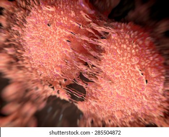 Cancer Cell Division Of Two Prostate Cancer Cells In The Final Stage Of Cell Division (cytokinesis) Cytoplasm Divides. The Cells Are Joined By Several Thin Cytoplasmic Bridges. They  To Form Tumours