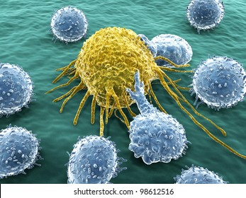Cancer cell and lymphocytes