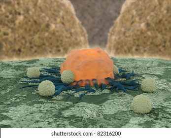 Cancer Cell With In Lymphocytes In The Surrounding Trying To Eliminate The Tumor Cell