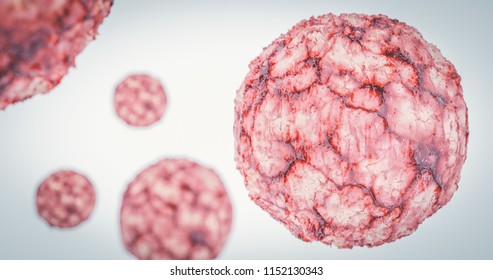 Cancer Cell Oncology Concept Cancer Tumor Cyst Carcinoma Lymphoma Colon Cancer Brest Cancers  3d Rendering 