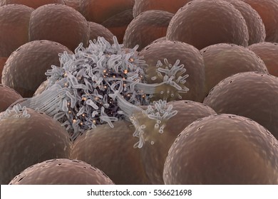 Cancer Cell Spreading Among Healthy Cell Stem Cells 