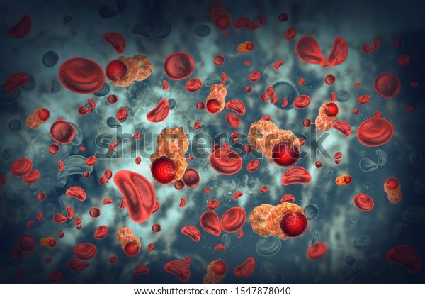 Cancer Cells Infected Blood3d Illustration Stock Illustration 1547878040