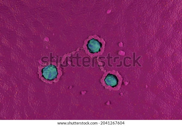 Cancerous colon surface super macro\
colorectal cancer top view 3d\
illustration