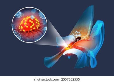 Cancers develop inside the ear. 3d illustration